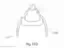 Fig. 16 - POSITIONING DEVICE AND METHOD FOR USE WITH A PATIENT UNDER ANESTHESIA