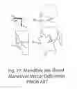 Fig. 27 - POSITIONING DEVICE AND METHOD FOR USE WITH A PATIENT UNDER ANESTHESIA