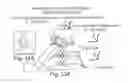 Fig. 33 - POSITIONING DEVICE AND METHOD FOR USE WITH A PATIENT UNDER ANESTHESIA