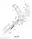 Fig. 11 - Surgical leg positioner