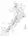 Fig. 10 - Surgical leg positioner