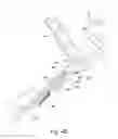 Fig. 11 - Surgical leg positioner