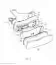 Fig. 04 - Load detecting device and walk assisting device