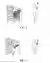 Fig. 19 - MASSAGE DEVICE