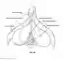 Fig. 26 - DEVICES AND METHODS FOR PROMOTING FEMALE SEXUAL WELLNESS
