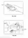 Fig. 30 - DEVICES AND METHODS FOR PROMOTING FEMALE SEXUAL WELLNESS