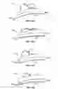 Fig. 32 - DEVICES AND METHODS FOR PROMOTING FEMALE SEXUAL WELLNESS