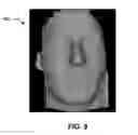 Fig. 10 - System and Method for Treating Skin and Underlying Tissues for Improved Health, Function and/or Appearance