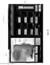 Fig. 15 - System and Method for Treating Skin and Underlying Tissues for Improved Health, Function and/or Appearance