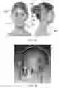 Fig. 41 - System and Method for Treating Skin and Underlying Tissues for Improved Health, Function and/or Appearance