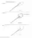 Fig. 02 - Method and apparatus for treating ear infections