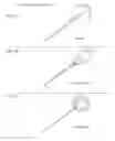 Fig. 05 - Method and apparatus for treating ear infections