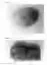 Fig. 05 - Hydrophilic Microparticles, Drug-Delivery Material, Method For Manufacturing Thereof And Methods For Delivery of A Drug-Delivery Composition