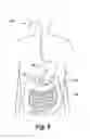Fig. 02 - LONG DELAYED RELEASE LAXATIVE