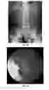 Fig. 02 - Enterically coated cysteamine, cystamine and derivatives thereof