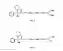Fig. 02 - METHODS FOR THE TREATMENT OF SIALORRHEA