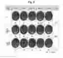 Fig. 03 - BOWEL CLEANSING COMPOSITION