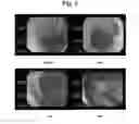 Fig. 04 - BOWEL CLEANSING COMPOSITION