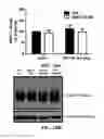 Fig. 17 - Compositions and Methods for Treating Autism Spectrum Disorders