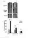 Fig. 15 - Composition for controlling a gut immunity and use thereof