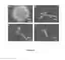 Fig. 13 - Nucleic acid particles, methods and use thereof