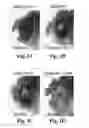 Fig. 02 - Compositions and methods for treating alzheimer's disease and other tauopathies