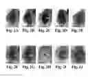 Fig. 05 - Compositions and methods for treating alzheimer's disease and other tauopathies
