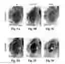 Fig. 10 - Compositions and methods for treating alzheimer's disease and other tauopathies