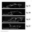 Fig. 11 - Compositions and methods for treating alzheimer's disease and other tauopathies