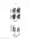 Fig. 17 - Compositions and methods for treating alzheimer's disease and other tauopathies