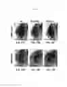 Fig. 23 - Compositions and methods for treating alzheimer's disease and other tauopathies