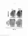 Fig. 24 - Compositions and methods for treating alzheimer's disease and other tauopathies
