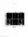 Fig. 29 - Compositions and methods for treating alzheimer's disease and other tauopathies