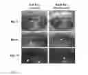 Fig. 10 - CLEARANCE OF BIOACTIVE LIPIDS FROM MEMBRANE STRUCTURES BY CYCLODEXTRINS