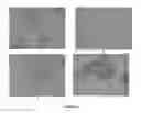 Fig. 06 - Pharmaceutical composition for improving health, cure abnormalities and degenerative disease, achieve anti-aging effect of therapy and therapeutic effect on mammals and method thereof