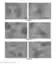 Fig. 60 - Pharmaceutical composition for improving health, cure abnormalities and degenerative disease, achieve anti-aging effect of therapy and therapeutic effect on mammals and method thereof