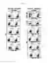 Fig. 17 - Peripheral blood stem cells with improved angiogenic properties and use thereof
