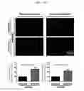 Fig. 20 - Peripheral blood stem cells with improved angiogenic properties and use thereof