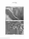Fig. 25 - Peripheral blood stem cells with improved angiogenic properties and use thereof