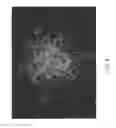 Fig. 07 - ISOLATION AND PURIFICATION OF HEMATOPOIETIC STEM CELLS FROM POST-LIPOSUCTION LIPOASPIRATES