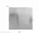Fig. 12 - Amniotic membrane preparations and purified compositions and anti-inflammation methods
