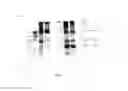 Fig. 13 - Amniotic membrane preparations and purified compositions and anti-inflammation methods