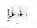Fig. 15 - Amniotic membrane preparations and purified compositions and anti-inflammation methods