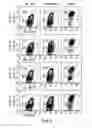 Fig. 09 - METHODS AND COMPOSITIONS FOR TREATMENT OF BONE DEFECTS WITH PLACENTAL CELL POPULATIONS