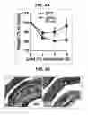 Fig. 30 - Composition for inducing proliferation or accumulation of regulatory T cells