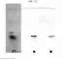 Fig. 05 - Pharmaceutical composition for preventing and treating obesity, containing green-tea see husk extract as active ingredient