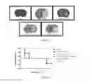 Fig. 19 - Compositions and methods for treating neuropsychiatric disorders using an endothelin-B receptor agonist