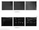 Fig. 22 - Compositions and methods for treating neuropsychiatric disorders using an endothelin-B receptor agonist