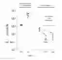 Fig. 02 - Methods and pharmaceutical compositions for the treatment of bacterial infections