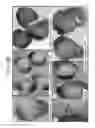 Fig. 13 - Leukolectins and uses thereof
